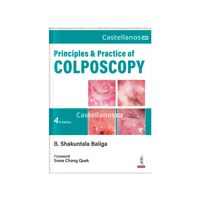 Principios y Práctica de la Colposcopia